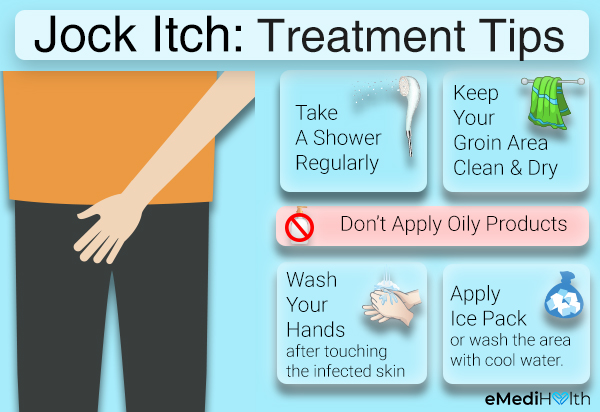 jock-itch-treatment-final.jpg